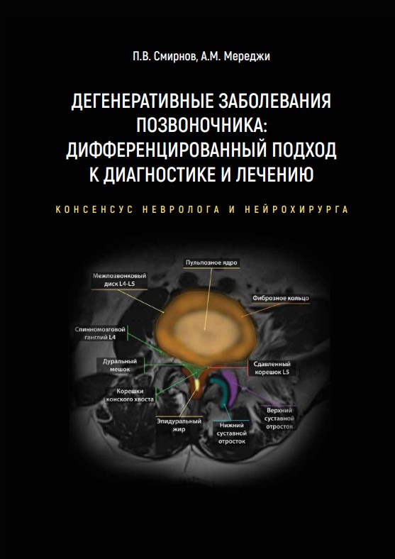 Дегенеративные заболевания позвоночника